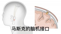 马斯克的脑机接口来了！它可以让残障人士通过